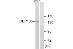 Western blot analysis of extracts from COLO cells, using CEP135 antibody. (CEP135 antibody  (C-Term))