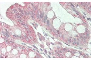 Detection of JAG1 in Human Colon Tissue using Polyclonal Antibody to Jagged 1 (JAG1) (JAG1 antibody  (AA 836-1047))