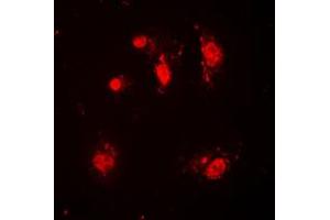 Immunofluorescent analysis of SKP2 staining in HeLa cells.