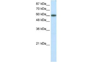 WB Suggested Anti-KLF11 Antibody Titration: 1. (KLF11 antibody  (N-Term))