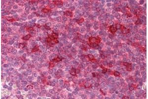 Human Spleen: Formalin-Fixed, Paraffin-Embedded (FFPE) (KLHL25 antibody  (Internal Region))