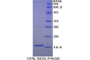 SDS-PAGE analysis of Human Histatin 1 Protein.