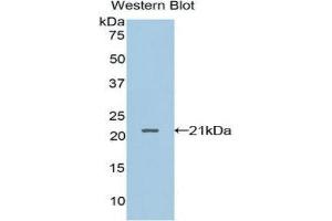 Western Blotting (WB) image for anti-Leukocyte Cell-Derived Chemotaxin 2 (LECT2) (AA 1-151) antibody (ABIN3203619) (LECT2 antibody  (AA 1-151))