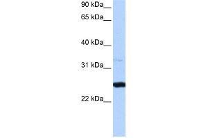 WB Suggested Anti-PRTFDC1 Antibody Titration:  0. (PRTFDC1 antibody  (Middle Region))