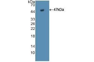 Detection of Recombinant FAS, Human using Polyclonal Antibody to Factor Related Apoptosis (FAS)