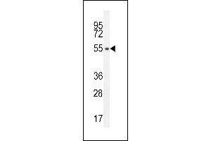 S35E2 Antibody (N-term) (ABIN654754 and ABIN2844438) western blot analysis in HL-60 cell line lysates (35 μg/lane). (SLC35E2 antibody  (N-Term))
