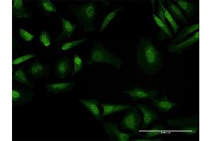Immunofluorescence of purified MaxPab antibody to BAHD1 on HeLa cell. (BAHD1 antibody  (AA 1-780))