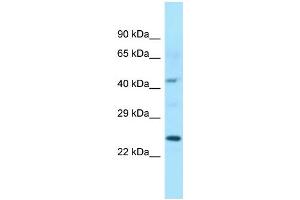 WB Suggested Anti-ISOC1 Antibody Titration: 1. (ISOC1 antibody  (C-Term))