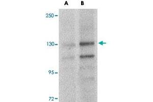 Western blot analysis of FRMPD4 in SK-N-SH cell lysate with FRMPD4 polyclonal antibody  at (A) 1 and (B) 2 ug/mL . (FRMPD4 antibody  (Internal Region))