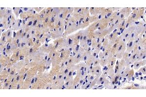 #VALUE! (PIK3C2A antibody  (AA 172-403))