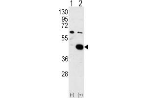 Western Blotting (WB) image for anti-Pyruvate Dehydrogenase Kinase, Isozyme 2 (PDK2) antibody (ABIN3002951) (PDK2 antibody)