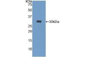 Detection of Recombinant Protein RPB837Mu01 with S-tag using Anti-S15 Oligopeptide (S) Tag Polyclonal Antibody (S15 Oligopeptide antibody)