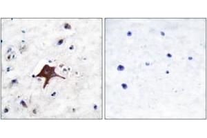 Immunohistochemistry analysis of paraffin-embedded human brain tissue, using GLUT3 Antibody. (SLC2A3 antibody  (AA 447-496))