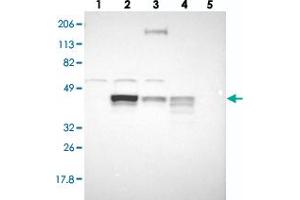 Western blot analysis of Lane 1: RT-4, Lane 2: U-251 MG, Lane 3: A-431, Lane 4: Liver, Lane 5: Tonsil with SLC9A3R2 polyclonal antibody  at 1:250-1:500 dilution. (SLC9A3R2 antibody)