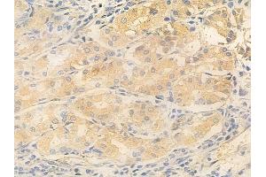 ABIN6266341 and ABIN6277067 at 1/100 staining human normal gastric tissue by IHC-P. (GSK3 alpha/beta antibody  (N-Term))