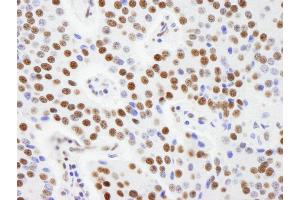Immunohistochemistry (IHC) image for anti-A Kinase (PRKA) Anchor Protein 8-Like (AKAP8L) (AA 596-646) antibody (ABIN7448929) (AKAP8L antibody  (AA 596-646))
