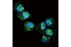 Confocal immunofluorescent analysis of UCHL1 Antibody (N-term) (ABIN388868 and ABIN2839164) with NCI- cell followed by Alexa Fluor 488-conjugated goat anti-rabbit lgG (green). (UCHL1 antibody  (N-Term))