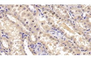 Detection of FGF3 in Human Kidney Tissue using Polyclonal Antibody to Fibroblast Growth Factor 3 (FGF3) (FGF3 antibody  (AA 154-232))