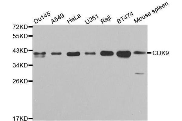 CDK9 antibody  (AA 153-372)