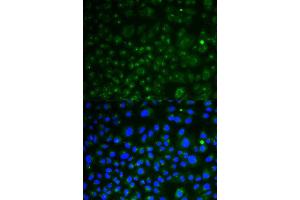 Immunofluorescence analysis of HeLa cell using LAMP1 antibody. (LAMP1 antibody  (AA 80-280))