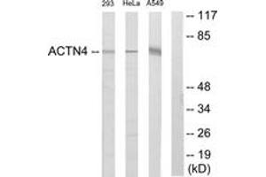 Western blot analysis of extracts from 293/HeLa/A549 cells, using ACTN1/2/3/4 Antibody. (ACTN1/2/3/4 antibody  (AA 21-70))
