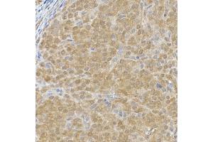 Immunohistochemistry of paraffin-embedded rat ovary using DC Rabbit mAb (ABIN7266685) at dilution of 1:200 (40x lens). (DCAF7 antibody)