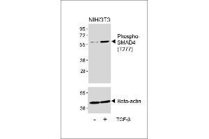Western blot analysis of lysates from NIH/3T3 cell line, untreated or treated with TGF-β(100 ng/mL, 30 min), using Phospho-SD4 Antibody (upper) or Beta-actin (lower). (SMAD4 antibody  (pThr277))