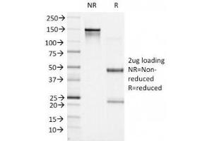SDS-PAGE Analysis of Purified, BSA-Free Bcl6 Antibody (clone BCL6/1527). (BCL6 antibody  (AA 256-389))