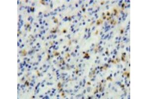IHC-P analysis of Spleen tissue, with DAB staining. (TCL1A antibody  (AA 1-114))