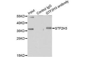 Immunoprecipitation analysis of 200ug extracts of HT-29 cells using 1ug GTF2H3 antibody.