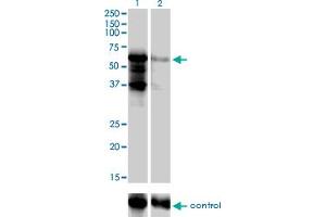 Western blot analysis of PKNOX2 over-expressed 293 cell line, cotransfected with PKNOX2 Validated Chimera RNAi (Lane 2) or non-transfected control (Lane 1). (PKNOX2 antibody  (AA 116-215))