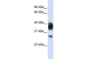 WB Suggested Anti-RNASEH1 Antibody Titration:  0. (Ribonuclease H1 antibody  (Middle Region))