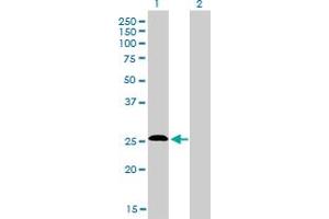 Western Blot analysis of C20orf18 expression in transfected 293T cell line by C20orf18 monoclonal antibody (M01), clone 3C3.