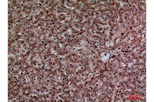 Immunohistochemistry (IHC) analysis of paraffin-embedded Human Liver, antibody was diluted at 1:100. (CEACAM1/5 antibody  (N-Term))