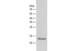 Western Blotting (WB) image for UFM1-Specific Peptidase 1 (Non-Functional) (UFSP1) (AA 1-142) protein (His tag) (ABIN7287642) (UFSP1 Protein (AA 1-142) (His tag))