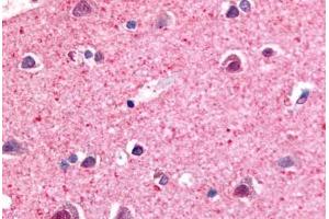 Anti-NR4A3 antibody  ABIN1049140 IHC staining of human brain, neurons and glia. (NR4A3 antibody  (Modulating Domain))