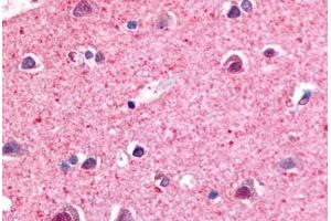 Anti-NR4A3 antibody  ABIN1049140 IHC staining of human brain, neurons and glia.