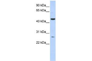 WB Suggested Anti-C6orf199 Antibody Titration: 0. (AKD1 antibody  (Middle Region))