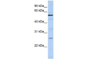 WB Suggested Anti-ZGPAT Antibody Titration:  0. (ZGPAT antibody  (C-Term))