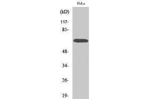 Western Blotting (WB) image for anti-V-Raf Murine Sarcoma 3611 Viral Oncogene Homolog (ARAF) (Ser155) antibody (ABIN3173857) (ARAF antibody  (Ser155))
