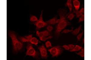 ABIN6269335 staining 293 by IF/ICC. (BCL2L1 antibody  (Internal Region))
