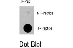 Image no. 1 for anti-3-phosphoinositide Dependent Protein Kinase-1 (PDPK1) (pSer396) antibody (ABIN358390) (PDPK1 antibody  (pSer396))