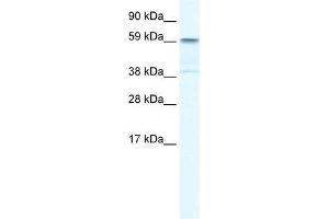 Human Liver; WB Suggested Anti-TRIM41 Antibody Titration: 0. (TRIM41 antibody  (C-Term))