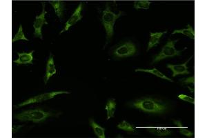 Immunofluorescence of monoclonal antibody to RARA on HeLa cell. (Retinoic Acid Receptor alpha antibody  (AA 315-424))