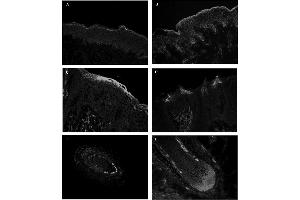 Immunohistochemical staining of repetin using anti-Repetin, pAb (AF646)  and FITC-labeled anti-rabbit IgG antibody on frozen section of human skin (A), human foreskin (B), human tongue (C and D) and human hair follicles (E and F). (Repetin antibody  (AA 570-584))