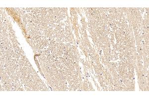 Detection of CPLX1 in Human Cerebrum Tissue using Polyclonal Antibody to Complexin 1 (CPLX1) (Complexin 1 antibody  (AA 1-134))