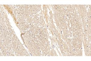 Detection of CPLX1 in Human Cerebrum Tissue using Polyclonal Antibody to Complexin 1 (CPLX1)