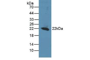 Detection of Recombinant REV1, Human using Polyclonal Antibody to REV1 Homolog (REV1)