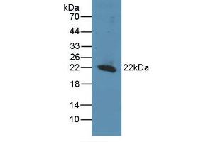 Detection of Recombinant REV1, Human using Polyclonal Antibody to REV1 Homolog (REV1) (REV1 antibody  (AA 301-478))