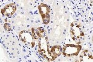 Immunohistochemistry analysis of paraffin-embedded human kidney using Endostatin (ABIN7073823) at dilution of 1:1200 (COL18A1 antibody)